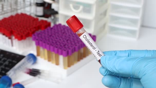 Prueba Colesterol Para Buscar Anomalías Sangre Muestra Sangre Para Analizar — Vídeo de stock