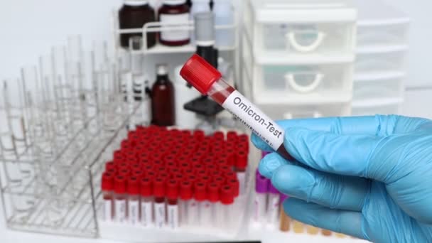 Omicron Test Cercare Anomalie Dal Sangue Campione Sangue Analizzare Laboratorio — Video Stock