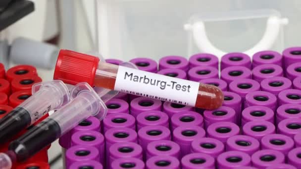 Examen Marburg Para Buscar Anormalidades Sangre Muestra Sangre Para Analizar — Vídeo de stock