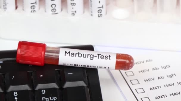 Marburg Teszt Keresni Rendellenességek Vér Vérminta Elemezni Laboratóriumban Vér Kémcsőben — Stock videók