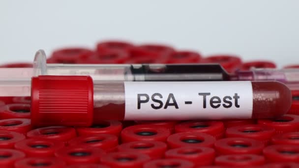Psa検査は 血液から異常を探すために 血液サンプルは 研究室で分析します 試験管内の血液 — ストック動画