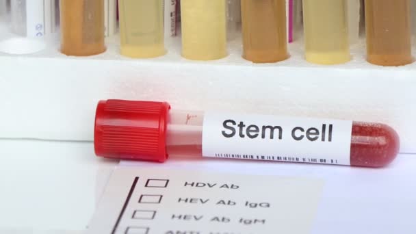 줄기세포는 혈액의 실험실에서 시험관에 혈액의 이상을 검사하기 검사한다 — 비디오