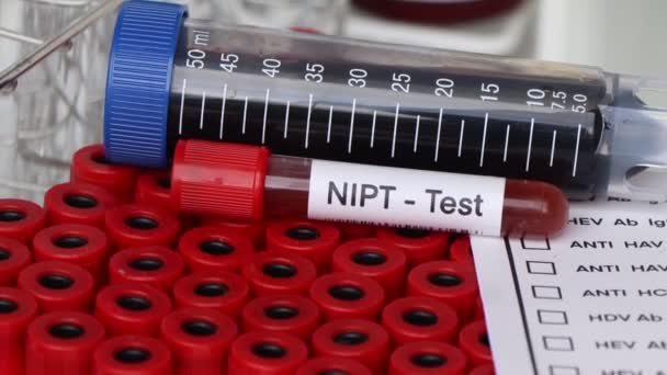 Nipt Δοκιμή Για Ψάξουν Για Ανωμαλίες Από Αίμα Δείγμα Αίματος — Αρχείο Βίντεο