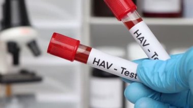 Kan anormalliklerini araştırmak için HAV testi laboratuvarda analiz edilecek kan örneği, test tüpünde kan.