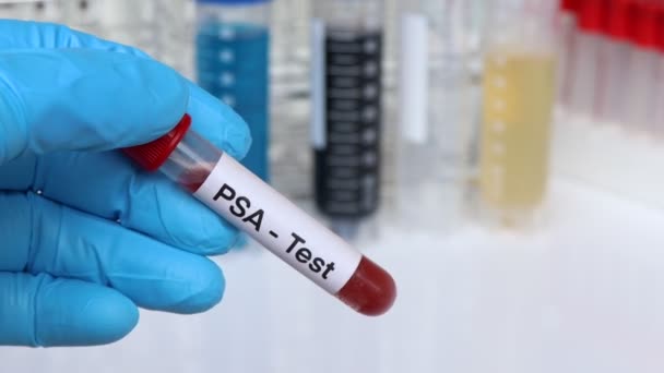 Psa检查从血液中寻找异常 在实验室分析血液样本 在试管中寻找血液样本 — 图库视频影像