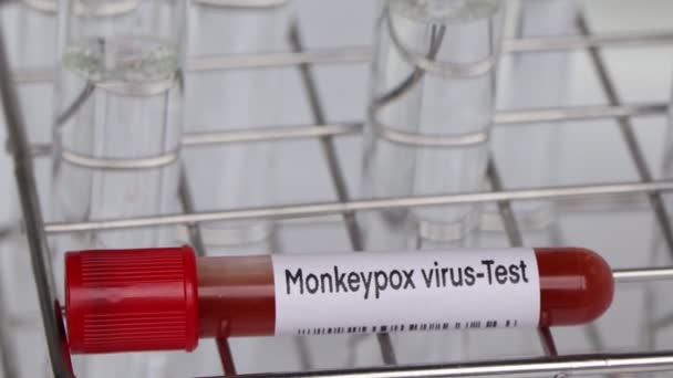 Δοκιμή Ιών Ευλογιάς Monkeypox Ψάξουν Για Ανωμαλίες Από Αίμα Δείγμα — Αρχείο Βίντεο