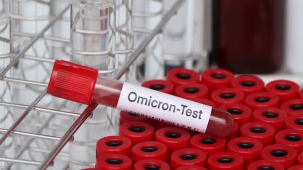 Δοκιμή Omicron Ψάξουν Για Ανωμαλίες Από Αίμα Δείγμα Αίματος Για — Αρχείο Βίντεο