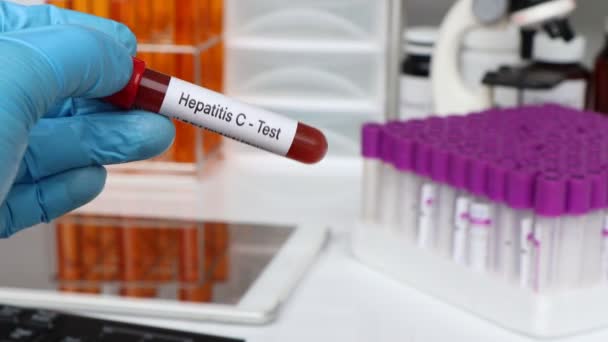Тест Гепатит Выявления Аномалий Крови Образца Крови Анализа Лаборатории Крови — стоковое видео