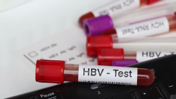 Hbv Teste Para Procurar Anormalidades Sangue Amostra Sangue Para Analisar — Vídeo de Stock