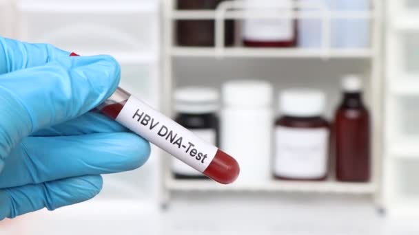 Hbv Dna Test Auf Auffälligkeiten Blut Blutprobe Zur Analyse Labor — Stockvideo