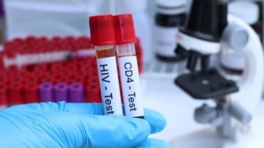 HIV testi ve CD4 testinde kandaki anormallikler, laboratuvarda analiz edilecek kan örnekleri, test tüpündeki kan örnekleri aranıyor.