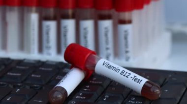 Laboratuvarda B12 vitamini test etmek için kan örnekleri, test tüpünde kan örneği.