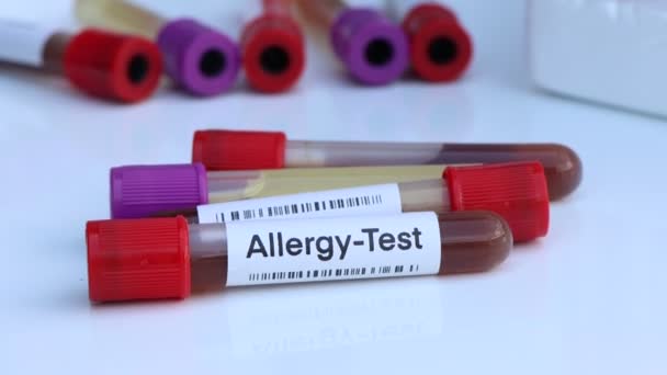 血液サンプルから検査室で分析する異常を探すためのアレルギー検査 検査管での血液 — ストック動画