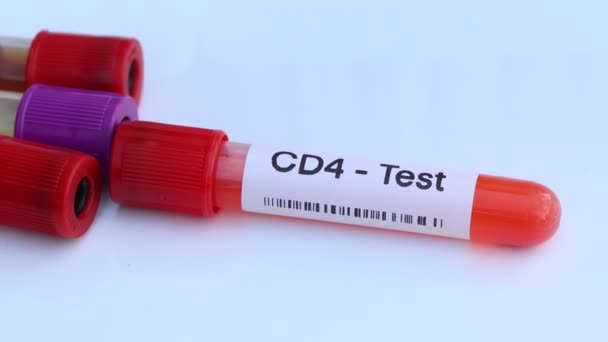 Test Cd4 Ricerca Anomalie Sangue Campione Sangue Analizzare Laboratorio Sangue — Video Stock