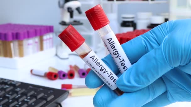 Аллергия Наличие Аномалий Крови Анализ Крови Лаборатории Кровь Пробирке — стоковое видео