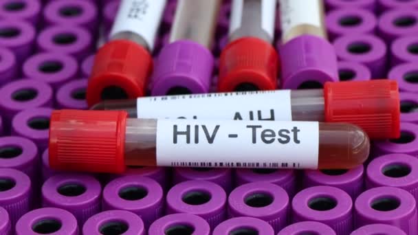 Test Hiv Cercare Anomalie Dal Sangue Campione Sangue Analizzare Laboratorio — Video Stock