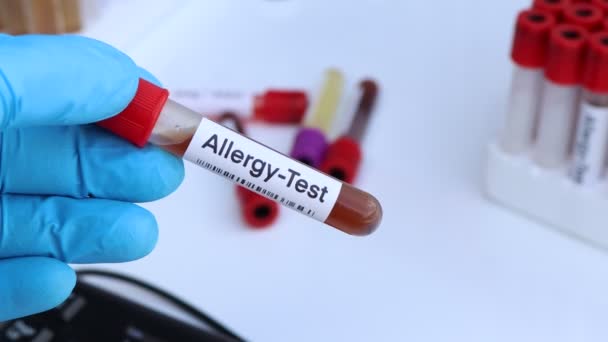 Badanie Alergiczne Obecność Nieprawidłowości Krwi Próbka Krwi Analizy Laboratorium Krew — Wideo stockowe