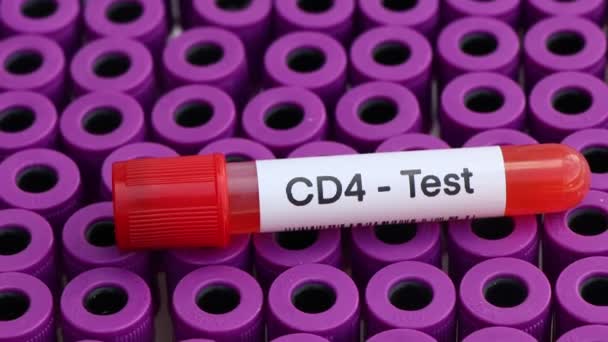Teste Cd4 Para Procurar Anormalidades Sangue Amostra Sangue Para Analisar — Vídeo de Stock