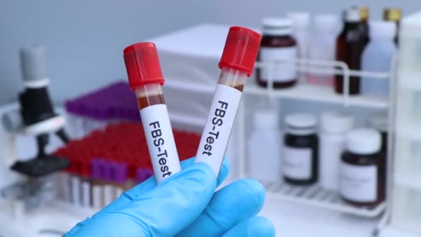 Badanie Fbs Celu Wykrycia Nieprawidłowości Krwi Próbki Krwi Analizy Laboratorium — Wideo stockowe