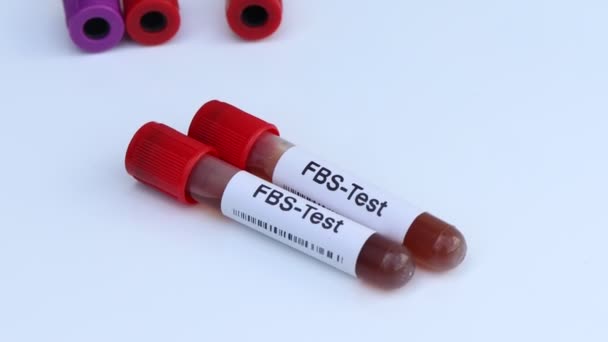 Test Fbs Ricerca Anomalie Sangue Campione Sangue Analizzare Laboratorio Sangue — Video Stock