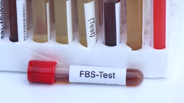 Prueba Fbs Para Buscar Anormalidades Sangre Muestra Sangre Para Analizar — Vídeo de stock