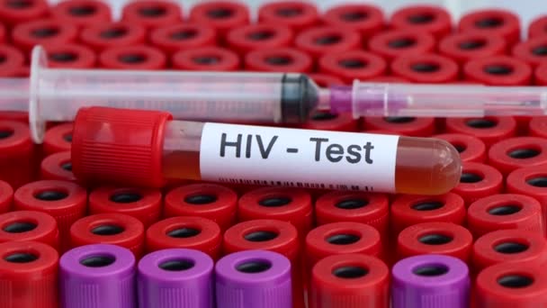 Teste Hiv Para Procurar Anormalidades Sangue Amostra Sangue Para Analisar — Vídeo de Stock