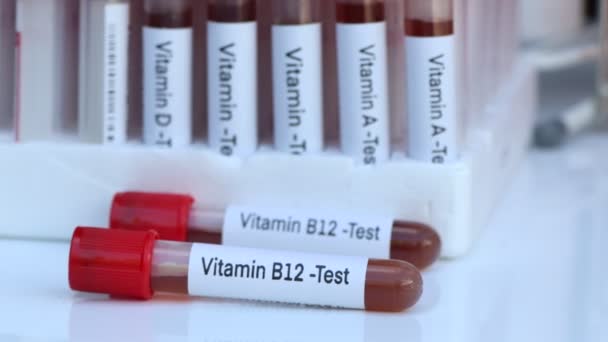 Blutproben Zum Test Von Vitamin B12 Labor Blutprobe Reagenzglas — Stockvideo