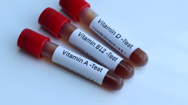Образцы Крови Тестирования Витамина Лаборатории Образцы Крови Пробирке — стоковое видео