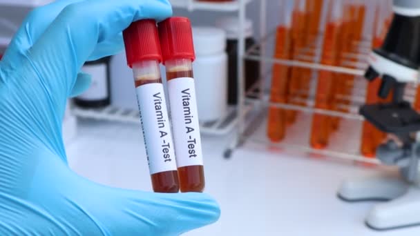Blodprov För Att Testa Vitamin Laboratoriet Blodprov Provröret — Stockvideo