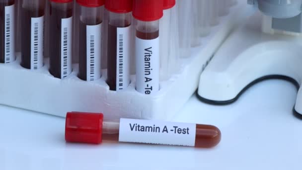 实验室检测维生素A的血样 试管的血样 — 图库视频影像