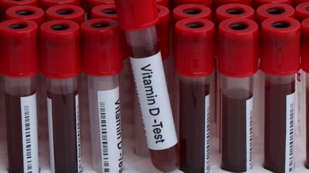 Próbki Krwi Badania Witaminy Laboratorium Próbka Krwi Probówce — Wideo stockowe