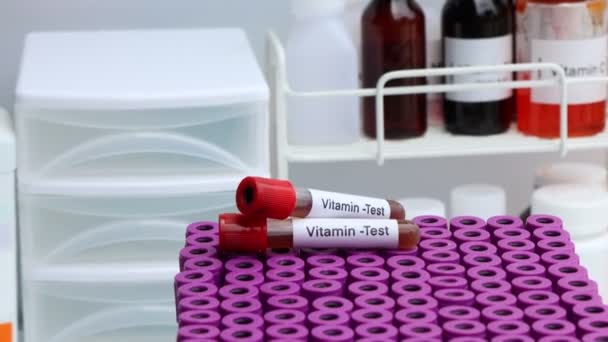 Muestras Sangre Para Análisis Vitaminas Laboratorio Muestras Sangre Tubo Ensayo — Vídeo de stock
