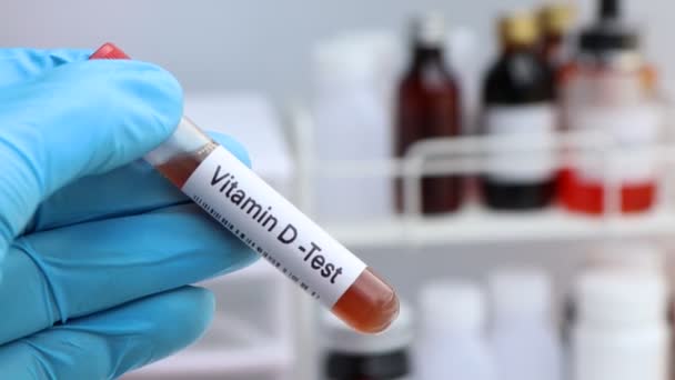 検査室でビタミンDを検査するための血液サンプル 検査管での血液サンプル — ストック動画