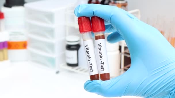 实验室检测维生素的血样 试管中的血样 — 图库视频影像
