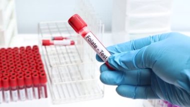 Kandaki anormallikleri araştırmak için şişme test laboratuvarda analiz edilecek kan örneği, test tüpünde kan.