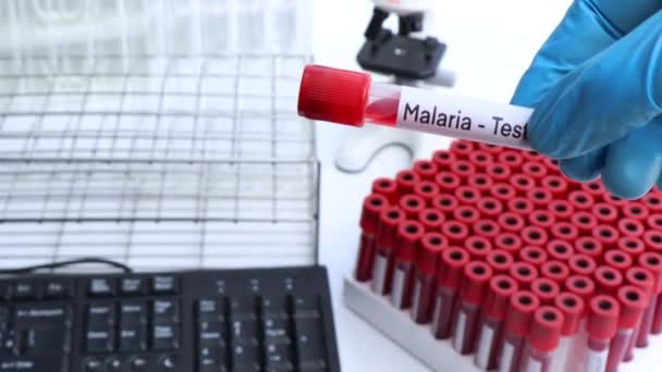Test Della Malaria Cercare Anomalie Dal Sangue Campione Sangue Analizzare — Video Stock