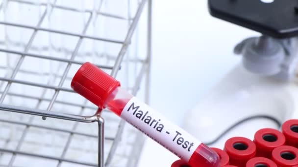 Teste Malária Para Procurar Anormalidades Sangue Amostra Sangue Para Analisar — Vídeo de Stock