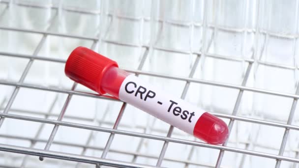 Тест Crp Наличие Отклонений Крови Образец Крови Анализа Лаборатории Кровь — стоковое видео
