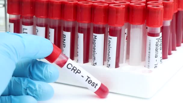 Crp Δοκιμή Για Ψάξουν Για Ανωμαλίες Από Αίμα Δείγμα Αίματος — Αρχείο Βίντεο
