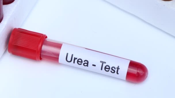Examen Urea Para Buscar Anormalidades Sangre Muestra Sangre Para Analizar — Vídeo de stock