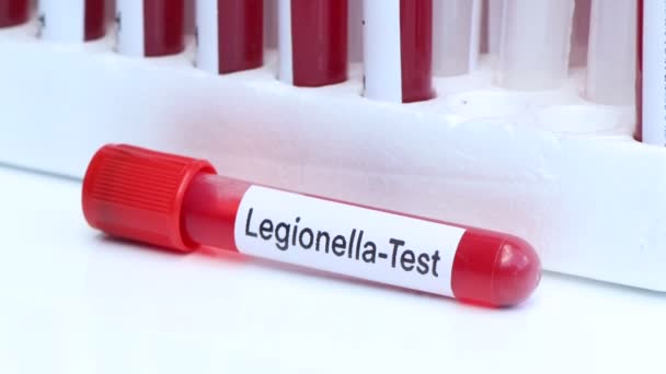 Teste Legionela Para Procurar Anormalidades Sangue Amostra Sangue Para Analisar — Vídeo de Stock