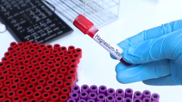Magnesium Test Zoeken Naar Afwijkingen Van Bloed Bloedmonster Analyseren Het — Stockvideo
