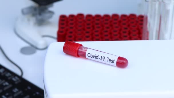 Teste Covid Para Procurar Anormalidades Sangue Amostra Sangue Para Analisar — Vídeo de Stock