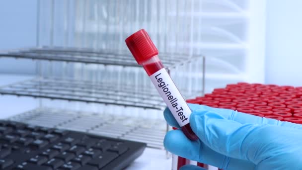 Badanie Legionelli Poszukiwaniu Nieprawidłowości Krwi Próbki Krwi Analizy Laboratorium Krew — Wideo stockowe