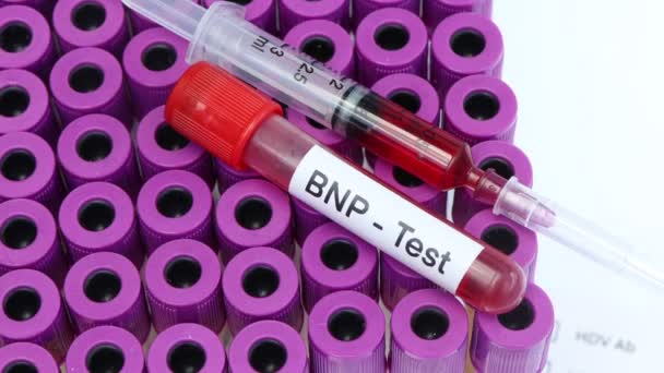 Teste Bnp Para Procurar Anormalidades Sangue Amostra Sangue Para Analisar — Vídeo de Stock