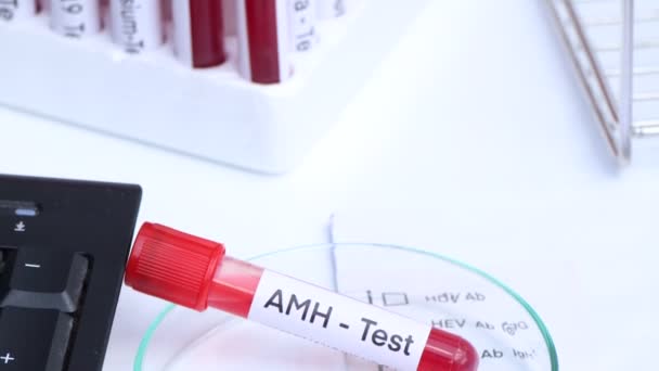 Тест Amh Наличие Отклонений Крови Образец Крови Анализа Лаборатории Кровь — стоковое видео