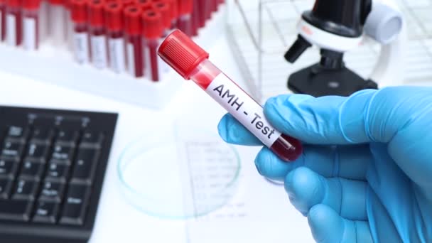 Amh Teszt Keresni Rendellenességek Vér Vérminta Elemezni Laboratóriumban Vér Kémcsőben — Stock videók