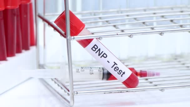 Тест Bnp Наличие Отклонений Крови Образец Крови Анализа Лаборатории Кровь — стоковое видео