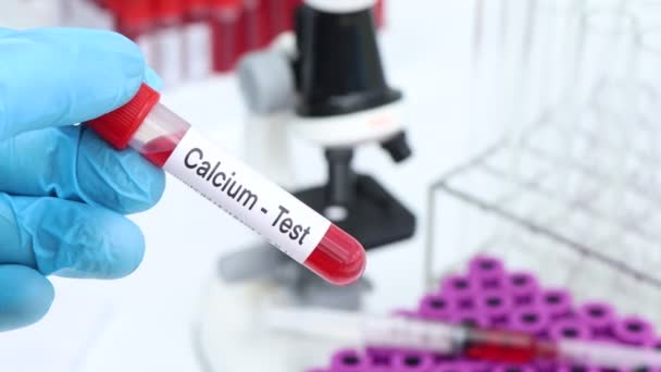 Calciumtest Kijken Naar Afwijkingen Van Bloed Bloedmonster Analyseren Het Laboratorium — Stockvideo