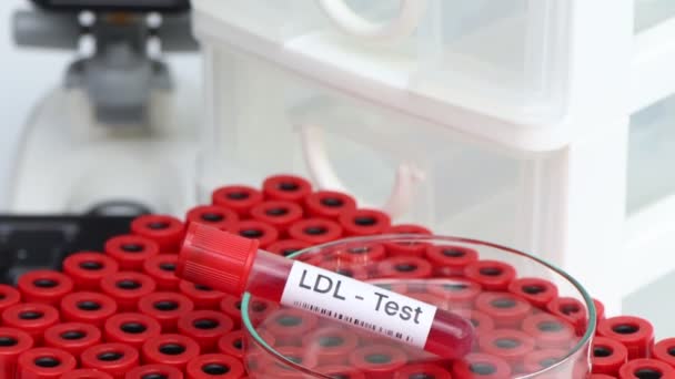 Test Ldl Cercare Anomalie Dal Sangue Campione Sangue Analizzare Laboratorio — Video Stock